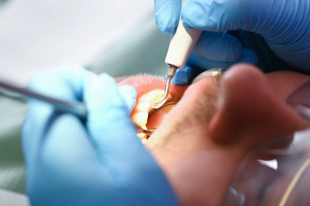 Best Weekend Emergency Dentist in Copperas Cove, TX