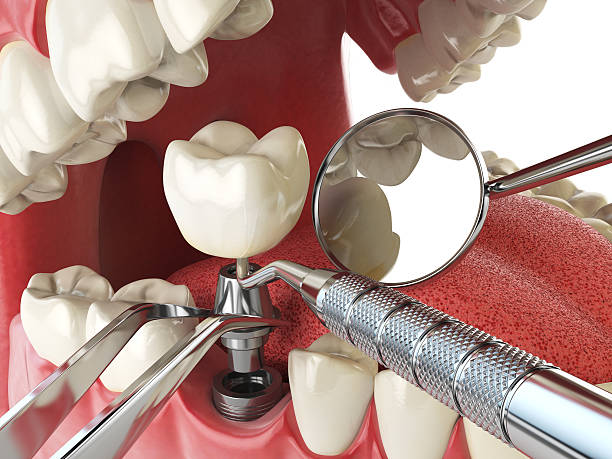 Best Emergency Dental Care for Abscessed Tooth in Copperas Cove, TX